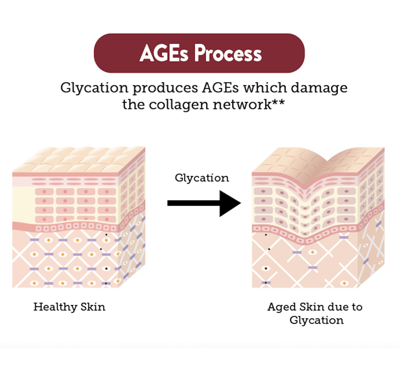 An antiglycation infographic showing how glycation ages skin